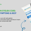 Eczema on Eyelids Cure: Causes, Symptoms & Best Creams